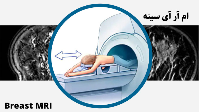 ام آر آی (MRI) پستان در مقایسه با روش‌های تصویربرداری دیگر، مزایا و عوارض