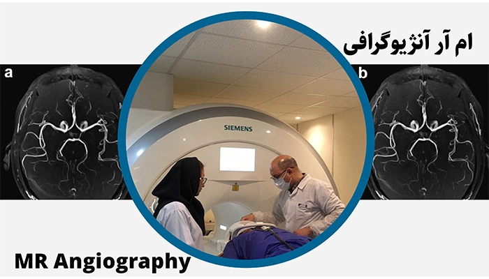ام آر آنژیوگرافی در شهرری
